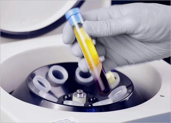 PRP in centrifuge
