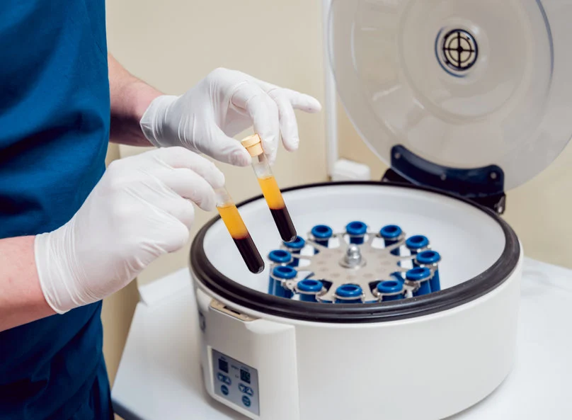 blood centrifuge machine